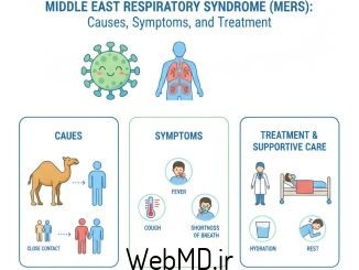 سندرم تنفسی خاورمیانه (MERS): علل، علائم و درمان