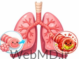 برونشیولیت چیست