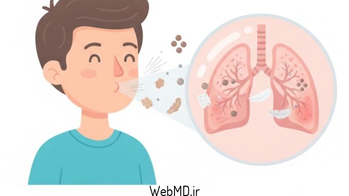 پنومونیت ناشی از حساسیت