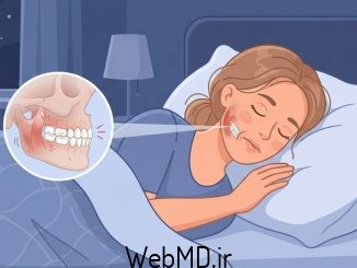 دندان قروچه و خواب (بروکسیسم خواب)