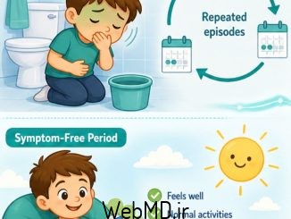 سندرم استفراغ دوره‌ای و میگرن شکمی