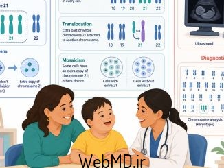 سندرم داون: علل، انواع و تشخیص