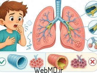 فیبروز سیستیک
