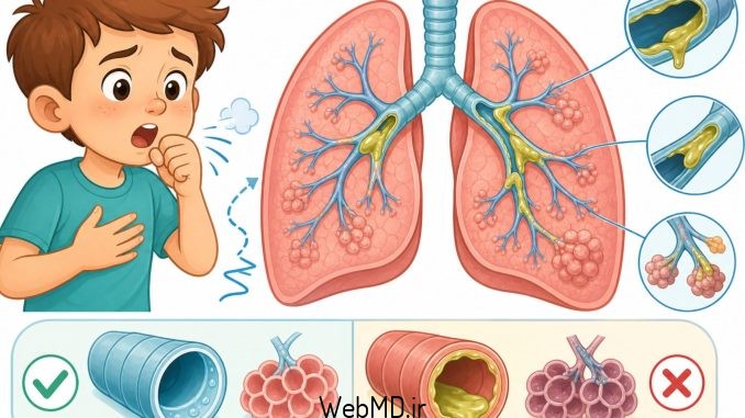 فیبروز سیستیک