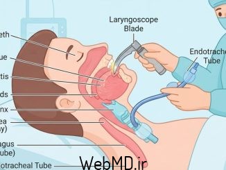 لوله گذاری توضیح داده شده است