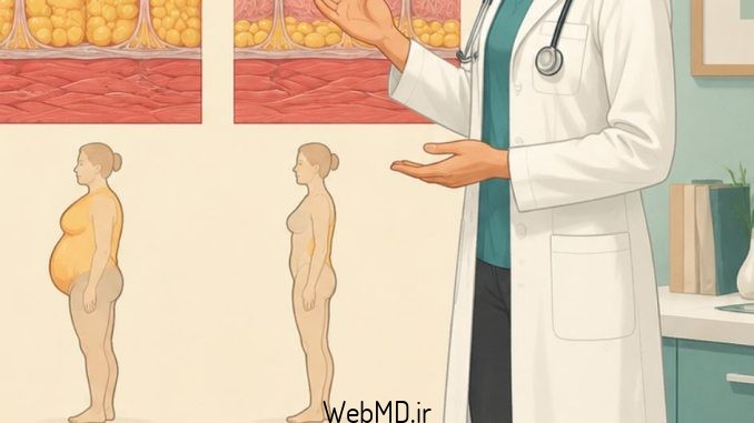 لیپودیستروفی اکتسابی