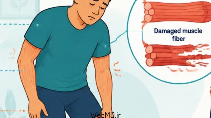 علائم میوپاتی الکلی علائم میوپاتی الکلی