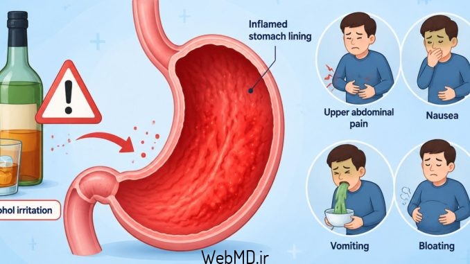 علل گاستریت الکلی علل گاستریت الکلی