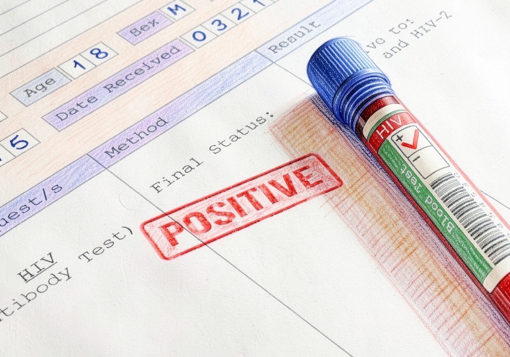 متوجه شدن اینکه به HIV مبتلا هستید میتواند زندگی شما را بهشدت تحت تأثیر قرار دهد و نگرانیهای زیادی ایجاد کند.