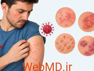 بثورات پوستی ناشی از HIV چه شکلی هستند و چگونه درمان می‌شوند؟