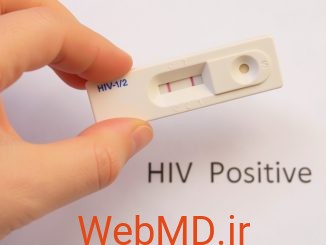 پس از تشخیص HIV مثبت چه باید کرد؟