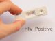 پس از تشخیص HIV مثبت چه باید کرد؟