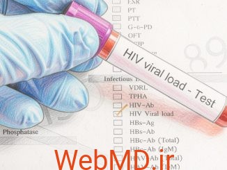 آیا با بار ویروسی غیرقابلتشخیص میتوان HIV را منتقل کرد؟