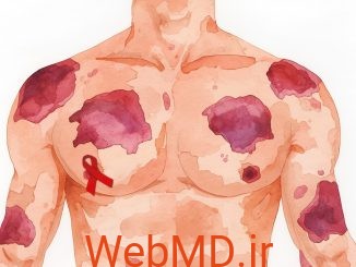 بیماریهای پوستی مرتبط با HIV/AIDS