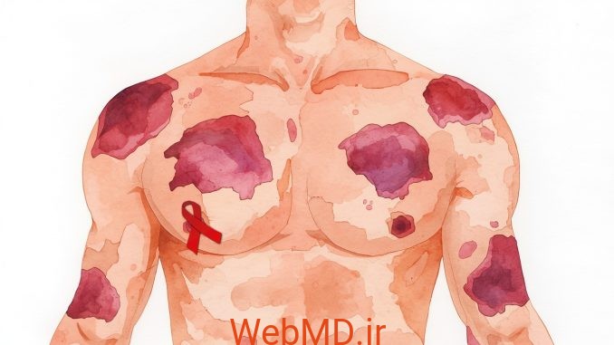 1 بیماریهای پوستی مرتبط با HIV/AIDS