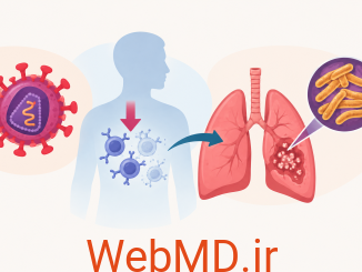 سل در افراد مبتلا به HIV