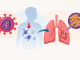 سل در افراد مبتلا به HIV