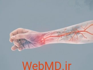 سندرم دیستروفی سمپاتیک رفلکسی (RSD) چیست؟