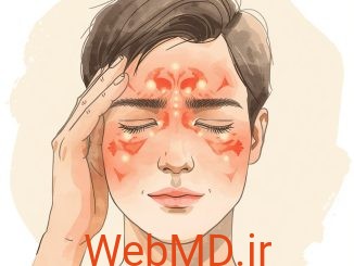 سینوزیت چیست؟