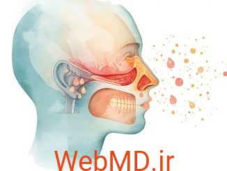 پولیپ بینی چیست؟
