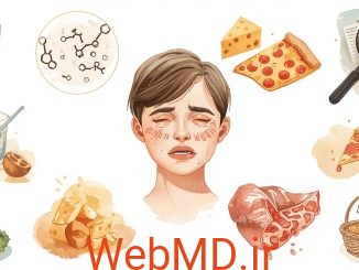 مروری بر آلرژی به کازئین