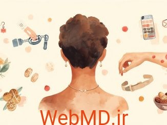 آیا به نیکل حساسیت دارید؟
