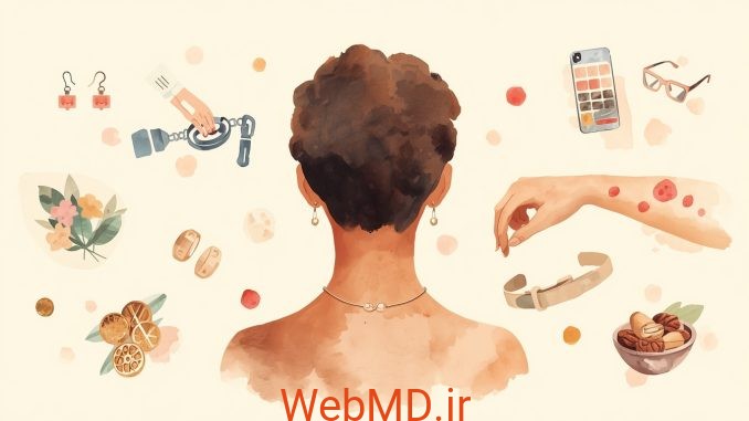 1 آیا به نیکل حساسیت دارید؟