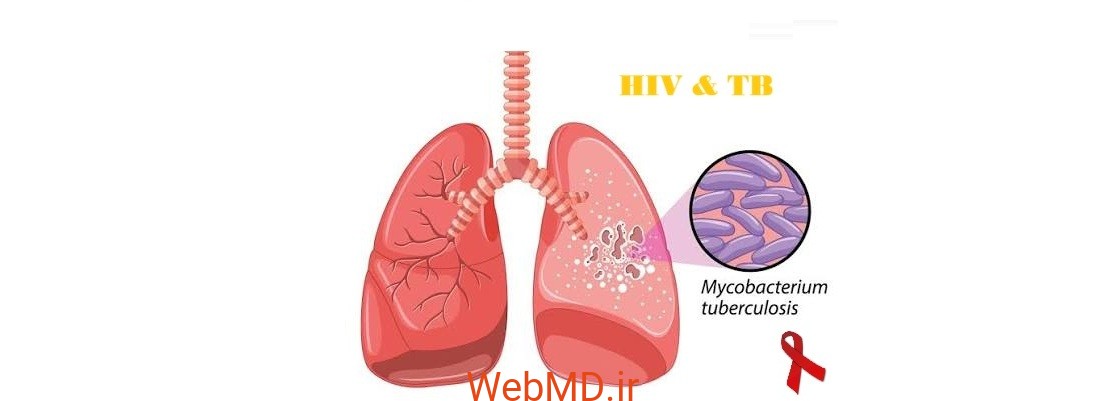 فردی که همزمان به HIV و سل مبتلاست، حداقل ۱۰ برابر بیشتر در معرض خطر ابتلا به سل فعال قرار دارد؛ این خطر بهویژه زمانی بیشتر است که تعداد سلولهای CD4 کمتر از ۲۰۰ باشد.